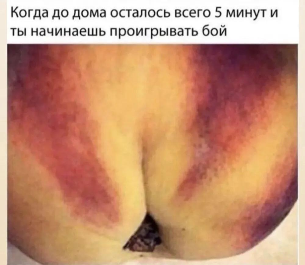 IMG-57d4beff40bbac188c9791d47ff8f3df-V.webp
